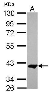 Anti-MEK1 Antibody