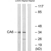 Anti-CA6 Antibody