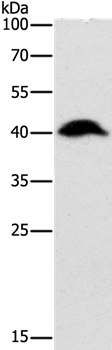 Anti-ADK Antibody