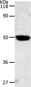 Anti-LOX Antibody