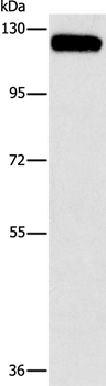 Anti-CBL Antibody