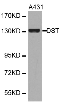 Anti-DST Antibody