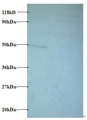 Anti-Protein AATF Antibody