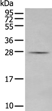 Anti-MBL2 Antibody