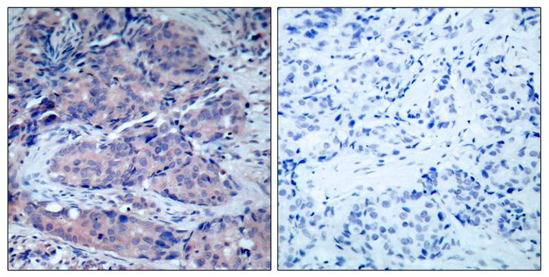 Anti-SEK1 / MKK4 (Ab-261) Antibody