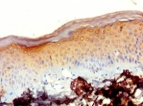 Anti-39S ribosomal protein L20, mitochondrial Antibody