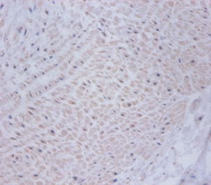 Anti-Cysteine and glycine-rich protein 2 Antibody