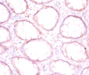 Anti-Protein disulfide-isomerase Antibody