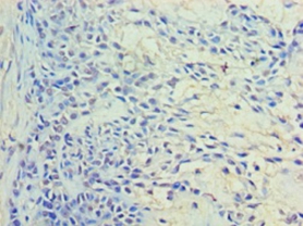 Anti-Ras-related protein Rab-11A Antibody