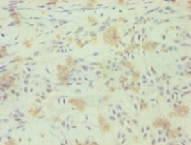 Anti-Nuclear receptor ROR-gamma Antibody