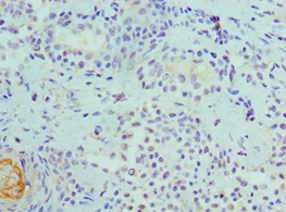 Anti-CDK8 Antibody