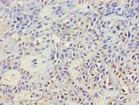 Anti-Cytoplasmic protein NCK2 Antibody