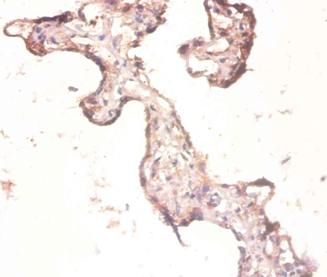 Anti-60S ribosomal protein L3 Antibody