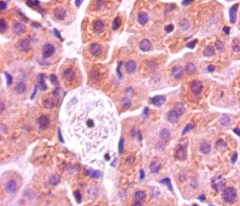 Anti-Protein-lysine 6-oxidase Antibody