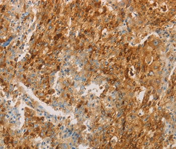 Anti-CEACAM8 Antibody