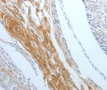 Anti-DNAJC10 Antibody