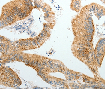 Anti-PGBD5 Antibody