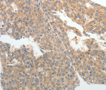 Anti-ABCB11 Antibody