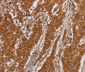 Anti-IL17RA Antibody