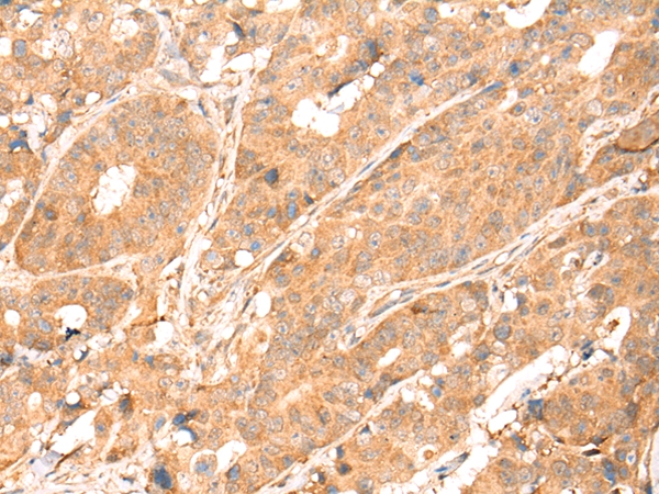 Anti-ABCA10 Antibody