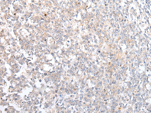 Anti-ABCB10 Antibody