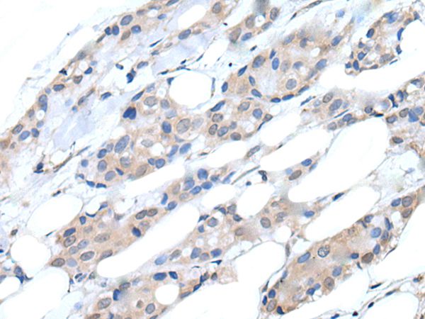 Anti-PIK3CA Antibody