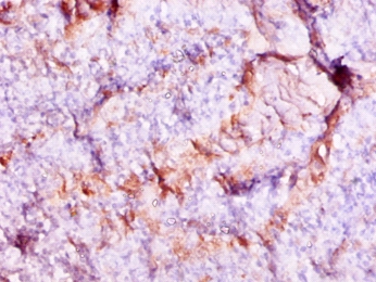 Anti-Protein S100-A9 Antibody