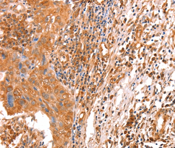 Anti-ACAD9 Antibody