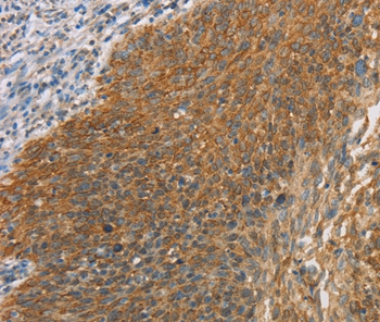 Anti-MAPK6 Antibody