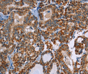 Anti-ABCB1 Antibody