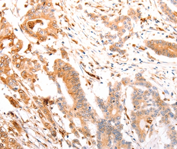 Anti-ABCA4 Antibody