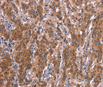 Anti-FDCSP Antibody