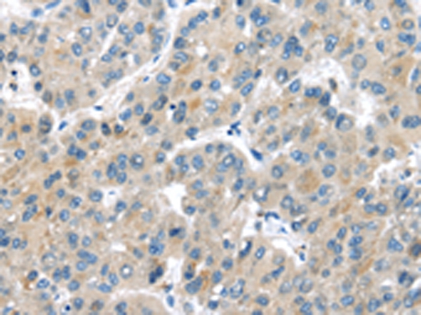 Anti-MASP2 Antibody