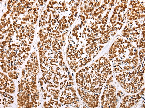 Anti-ABCA1 Antibody