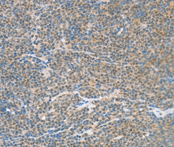 Anti-ATF2 Antibody