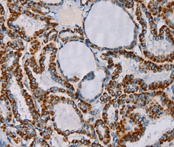 Anti-CMC4 Antibody