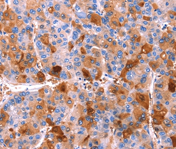 Anti-ERN2 Antibody