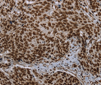 Anti-LEO1 Antibody