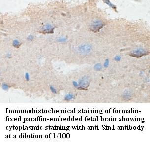 Anti-Sin1 Antibody