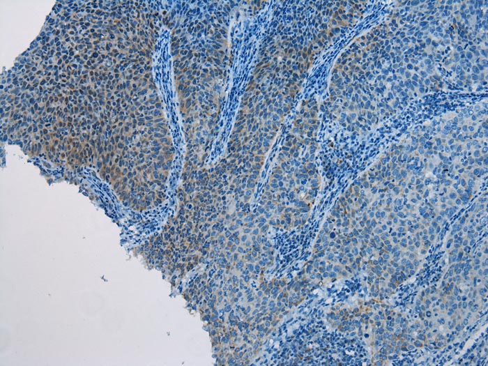 Anti-AQP7 Antibody