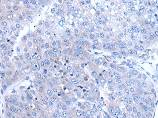 Anti-BTG4 Antibody