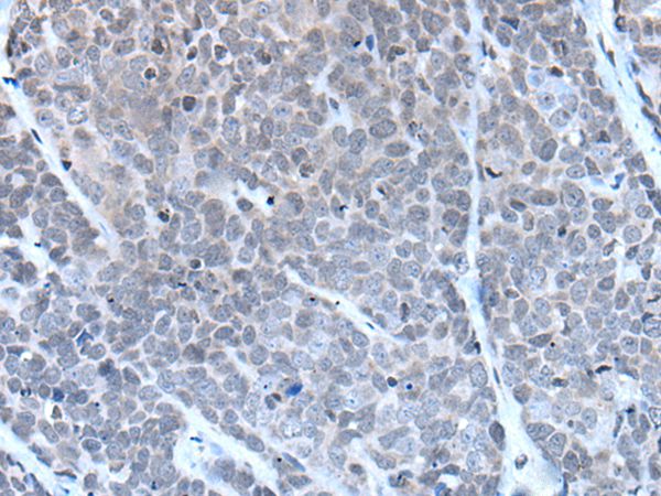 Anti-GJA5 Antibody