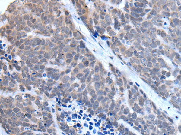 Anti-TBX6 Antibody