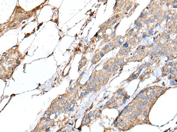 Anti-IL20 Antibody