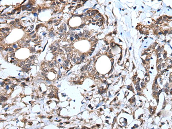 Anti-IRF4 Antibody