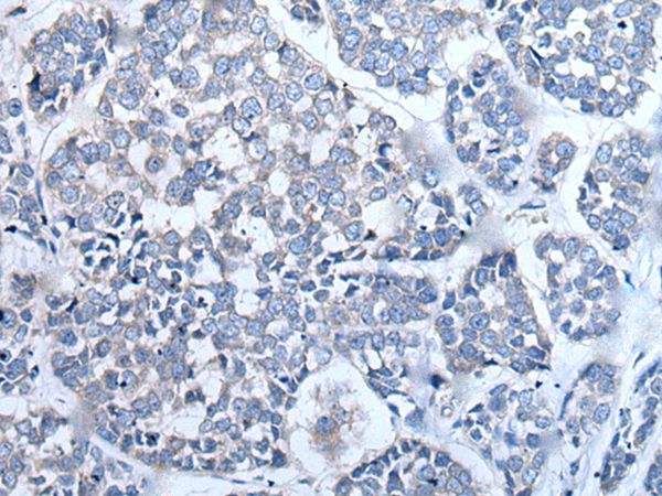 Anti-LCAT Antibody