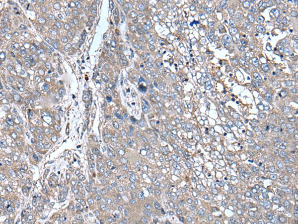 Anti-ZIC1 Antibody