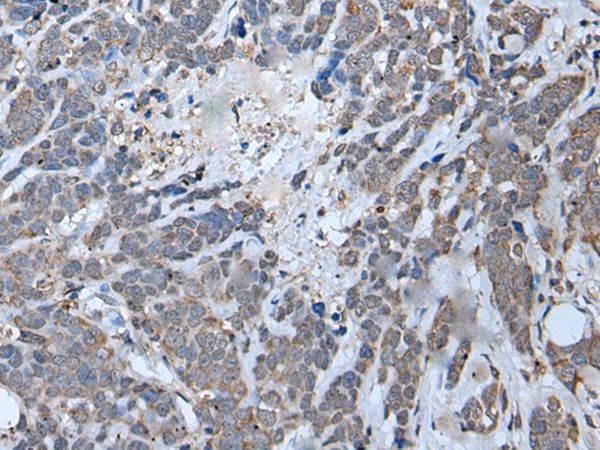 Anti-MYF6 Antibody