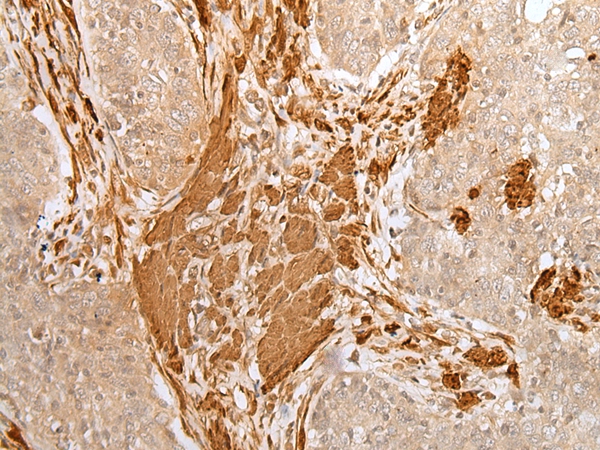 Anti-PF4 Antibody