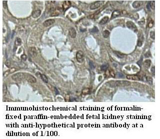 Anti-hypothetical protein Antibody